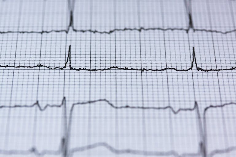 Close-up view of an ECG reading on graph paper, displaying heart rhythm and pulse data for medical analysis.